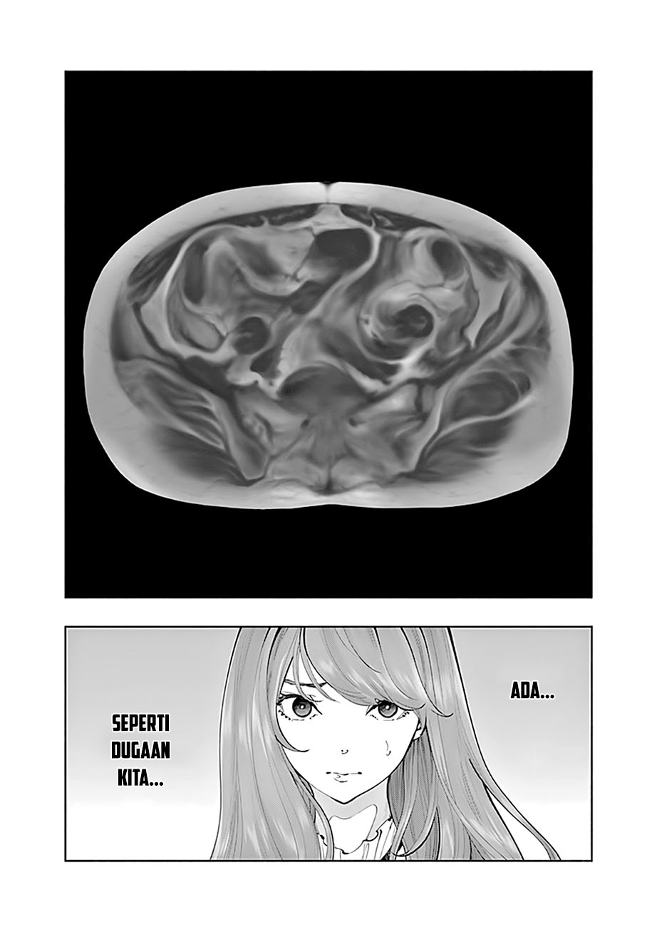 Chapter 67 - halaman 17